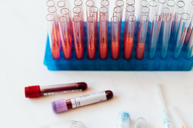 Anemia in gravidanza da cosa dipende